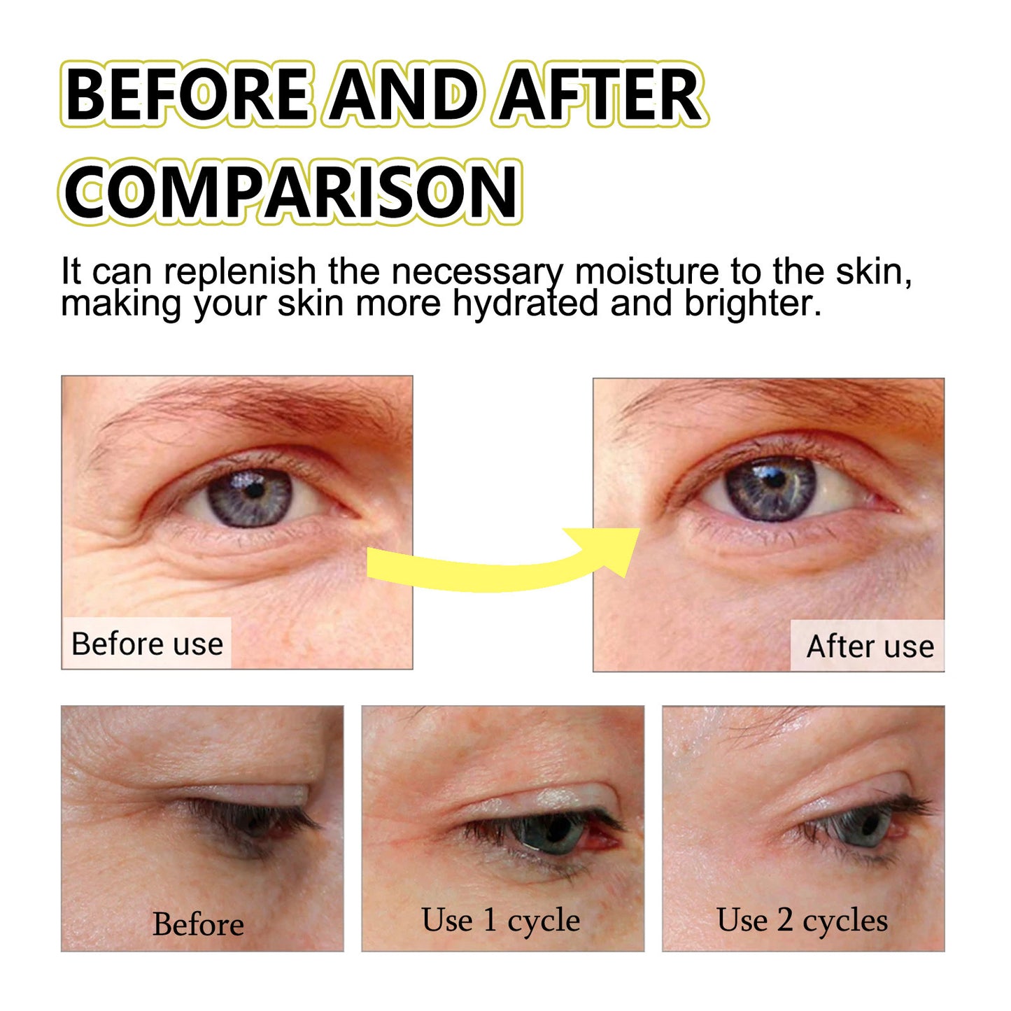 Anti-wrinkle Reducing Wrinkles Firming Sagging Sagging Skin