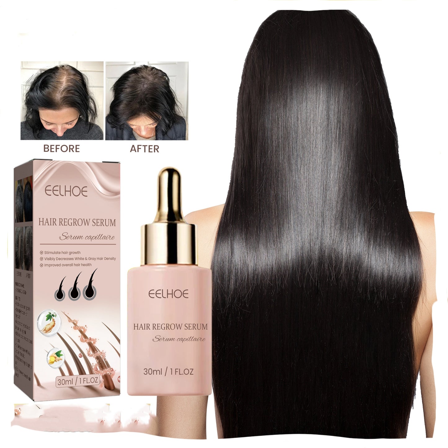 EELHOE Hair Dense Essence Hair Anti-hair Loss And Hair Fixation Nutrition